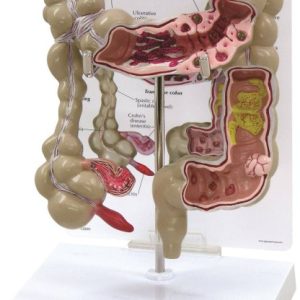 Colon Model