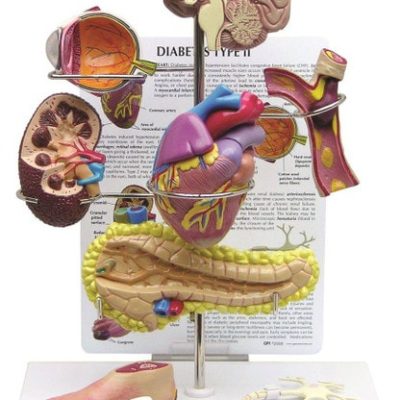Diabetes Model